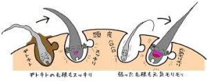 ダウンロード (6)