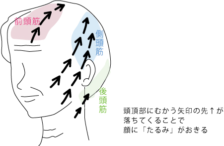 たるみ対策