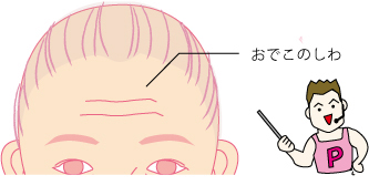 おでこのしわ